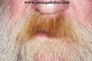 زرد شدن ريش و سبيل و توتون های بی كيفيت