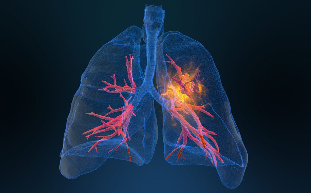 معجون پاکسازی ریه