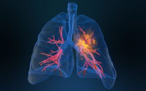 معجون پاکسازی ریه