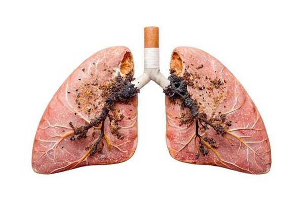 سیگار قاتل ریه‌ ها است