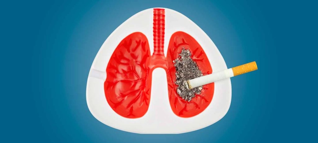 افزایش ابتلای غیر سیگاری‌ ها و زنان به سرطان ریه