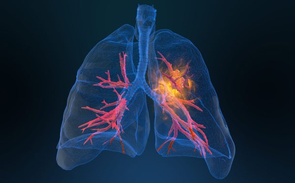 معجون پاکسازی ریه