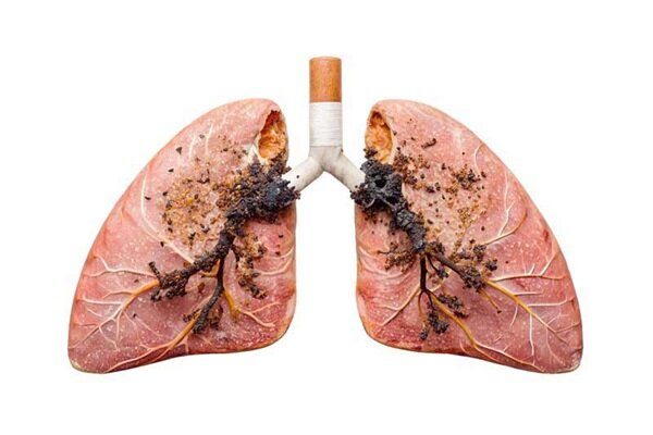 سیگار قاتل ریه‌ ها است