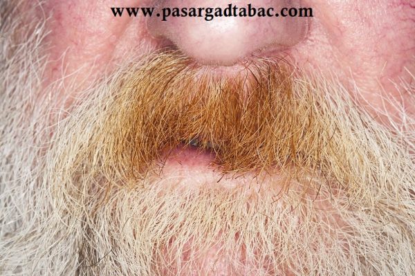 زرد شدن ریش و سبیل و توتون های بی کیفیت زرد شدن ريش و سبيل و توتون های بی كيفيت